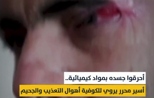 Thumbnail preview image for the video titled: Palestinian captive Mohammed al-Tawil as he recounts of how he was captured by the Israeli forces and tortured with chemicals