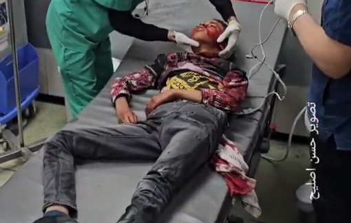 Thumbnail preview image for the video titled: Casualties among children in Israeli airstrike on Eid day