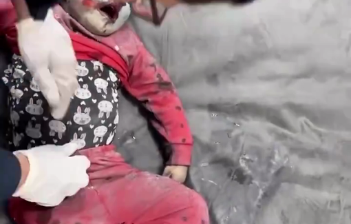 Thumbnail preview image for the video titled: Little girl injured in Israeli bombing of Al-Taif family house