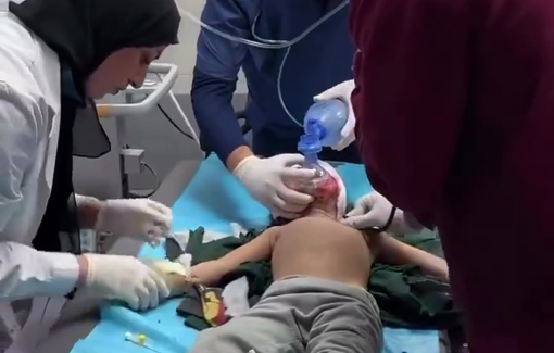 Thumbnail preview image for the video titled: Children injured in Israeli bombing of an apartment in Hamad city