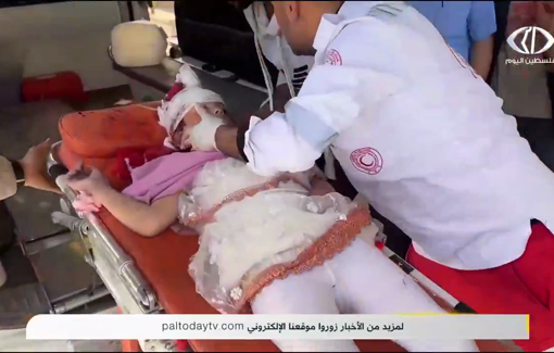 Thumbnail preview image for the video titled: Injured children rushed to hospital following an Israeli strike on a tent