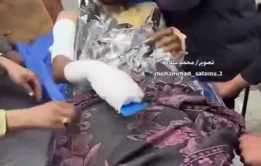 Thumbnail preview image for the video titled: Journalist Hassan Eslayeh transferred to the Gaza European Hospital