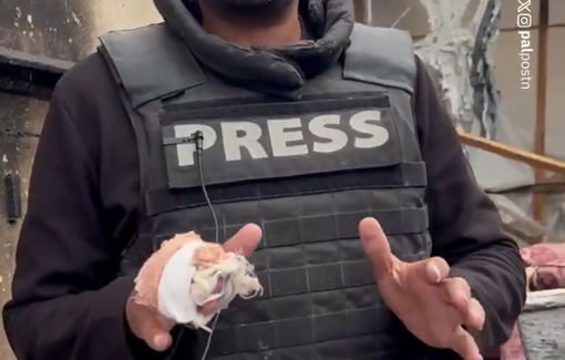 Thumbnail preview image for the video titled: Journalist Abdul-Raouf Shaat recounts moment Israel bombed the journalists' tent at Nasser hospital