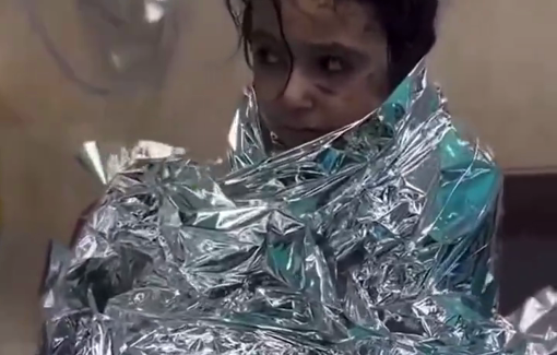 Thumbnail preview image for the video titled: Injured child trembling from fear