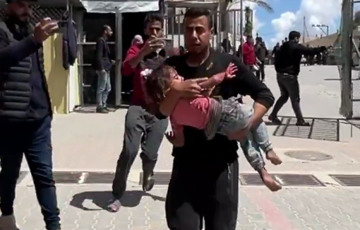 Thumbnail preview image for the video titled: Children injured in Israeli bombing of tents in Al-Mawasi