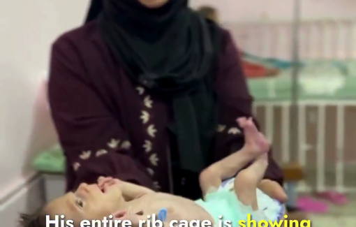 Thumbnail preview image for the video titled: 4 month-old Yousef al-Najjar severely underweight because of Israel's policy of starvation