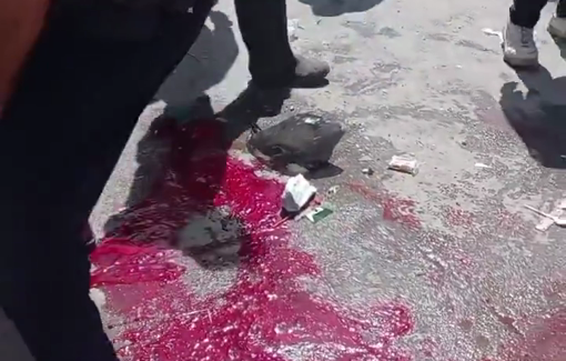 Thumbnail preview image for the video titled: Horrible massacre scene at busy street after Israeli strike killed over 30 people