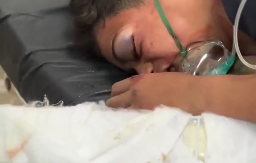 Thumbnail preview image for the video titled: Child in terrible pain from injuries from an Israeli bombing of a house