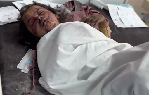 Thumbnail preview image for the video titled: Injured little girl in pain inside the Indonesian hospital besieged by Israel