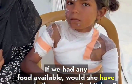 Thumbnail preview image for the video titled: Little girl covered in burns after falling in a pot at a community kitchen