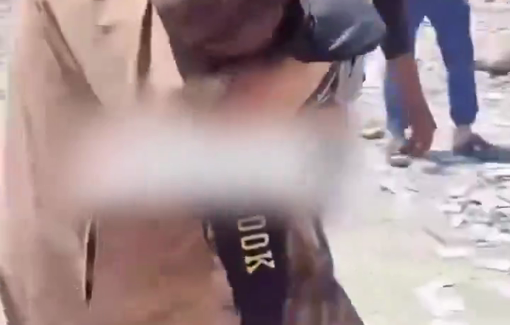 Thumbnail preview image for the video titled: Distraught father carries his only child critically wounded in a strike on their home