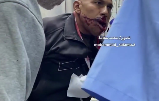 Thumbnail preview image for the video titled: Gravely wounded aid seekers arrive at hospital following another massacre at GHF sites