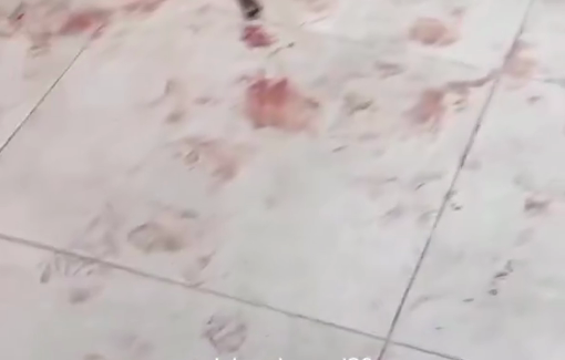 Thumbnail preview image for the video titled: Hospital floor blood-stained after aid seekers were massacred at the Netzarim GHF site