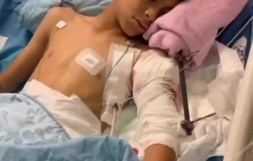 Thumbnail preview image for the video titled: The child Iyass Abu Mufleh, 13, from the town of At-Tur, was wounded after being shot by Israeli soldiers