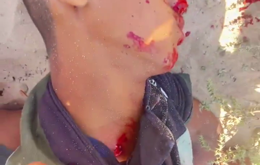 Thumbnail preview image for the video titled: Boy shot dead in the neck by Israeli forces while seeking aid at the Rafah GHF site
