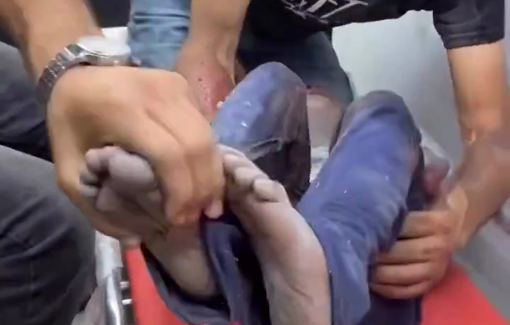 Thumbnail preview image for the video titled: Little girl in pain from injury in an Israeli evening strike on Gaza City