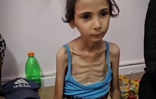 Thumbnail preview image for the video titled: Children face hunger and malnutrition under a suffocating siege