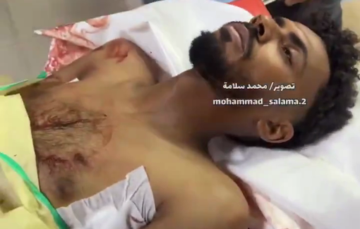 Thumbnail preview image for the video titled: Palestinian journalist Tamer Rabhi Al-Za'anin killed and photojournalist Ibrahim Abu Oushaiba during the abduction of Dr. Marwan Al-Hams, director of field hospitals in Gaza