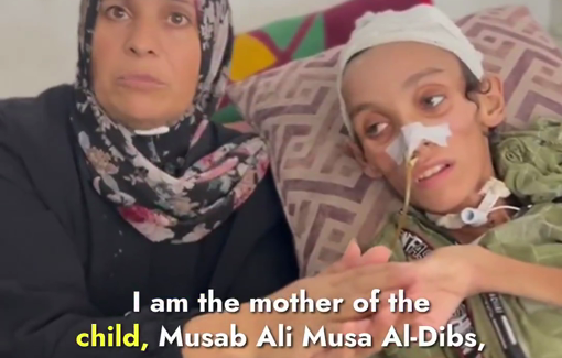 Thumbnail preview image for the video titled: Fourteen-year-old Musab Ali Musa Al-Dibs, already wounded in May, is now suffering from acute malnutrition