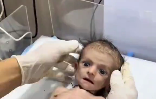 Thumbnail preview image for the video titled: The effect of starvation on the babies of Gaza