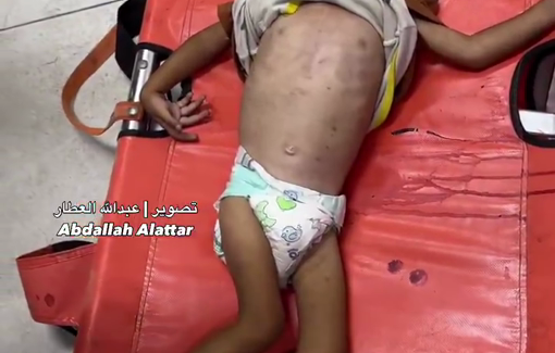 Thumbnail preview image for the video titled: One year-old Samir Abdul-Aal killed by Israel's starvation policy