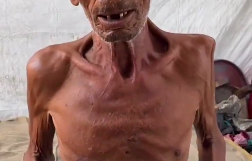 Thumbnail preview image for the video titled: Emaciated 75 y/o Salim Asfour slowly dying after losing his home and all belongings