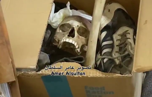 Thumbnail preview image for the video titled: Skeletal remains in an aid box