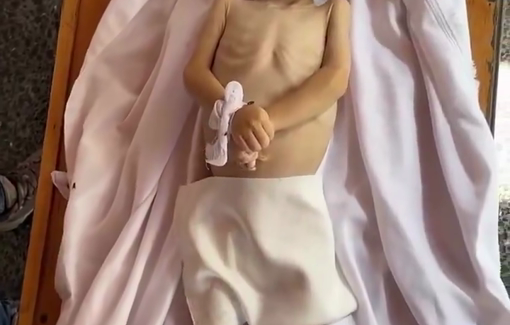 Thumbnail preview image for the video titled: Child Saif Helles killed by Israel's starvation policy