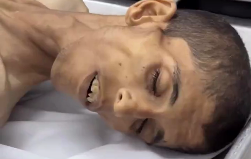Thumbnail preview image for the video titled: 30 year-old Wisam Abu Mohsen starved to death