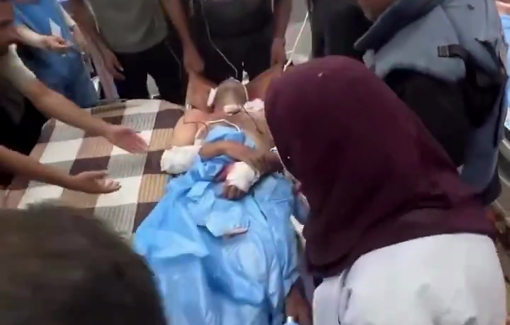 Thumbnail preview image for the video titled: Journalist Mohammed Fayq wounded in Israeli strike on Nasser hospital