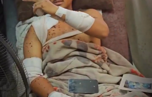 Thumbnail preview image for the video titled: Journalist Jamal Badah lost his leg in Israel's double tap on Nasser hospital