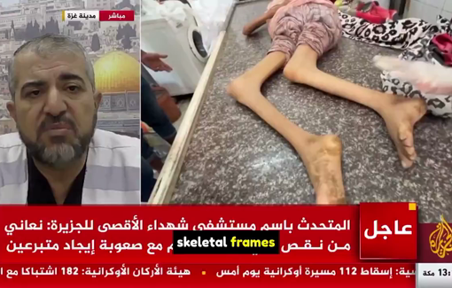 Thumbnail preview image for the video titled: Famine kills one person every 3 hours as epidemics spread and massacres continue unabated