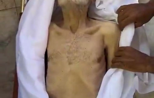 Thumbnail preview image for the video titled: 80 y/o Muhammad Aref killed by Israel's starvation policy
