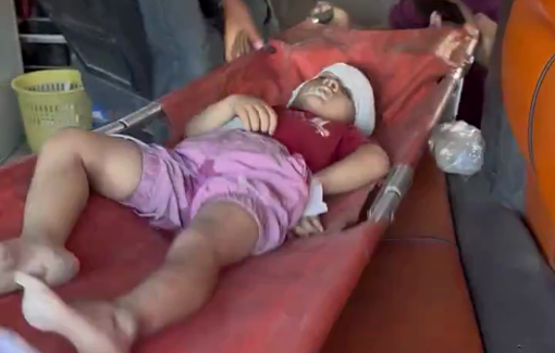 Thumbnail preview image for the video titled: Child injured in Israeli bombing of Al-Karama neighborhood, northwest Gaza City