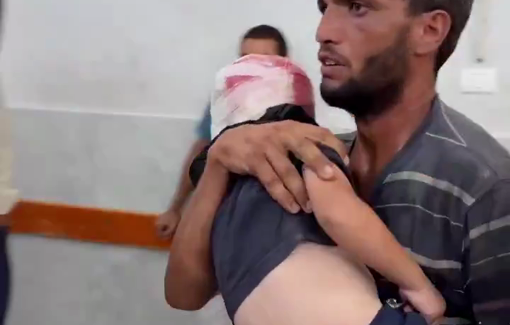 Thumbnail preview image for the video titled: Children injured in Israeli bombing in Al-Karama neighborhood, northwest Gaza City