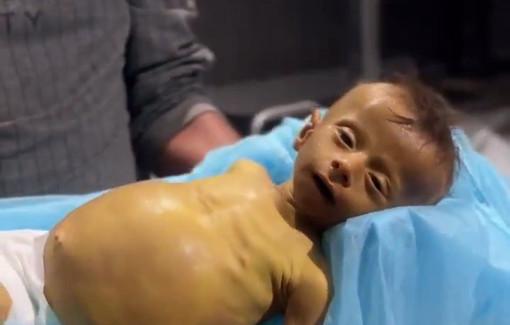 Thumbnail preview image for the video titled: Infant Mohamed Al-Masri killed by Israel's blockade on food and medical supplies