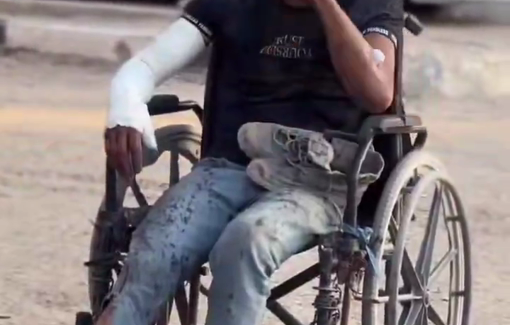 Thumbnail preview image for the video titled: Injured man in pain on his wheelchair