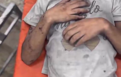 Thumbnail preview image for the video titled: Child injured in Israeli bombing of Al-Jamla family house in the Tuffah neighborhood