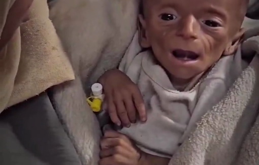 Thumbnail preview image for the video titled: Infant Eid Abu Jomaa dies to malnutrition and lack of medication amid Israeli blockade