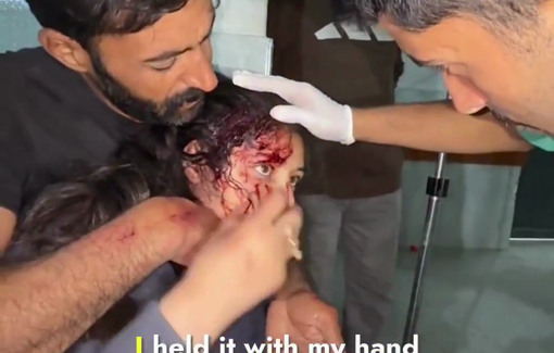 Thumbnail preview image for the video titled: Child injured by bullet that grazed her head