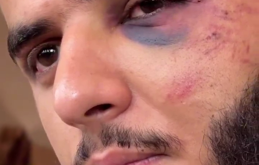 Thumbnail preview image for the video titled: Fidaa Salameh recounts how he and five other young men were abducted and tortured by Israeli soldiers in Jenin