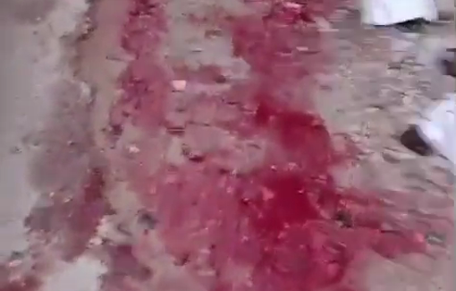 Thumbnail preview image for the video titled: The blood of a Palestinian child who was shot dead and abducted by Israeli forces in Al-Faraa