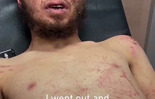 Thumbnail preview image for the video titled: Owais Dhieb, a young Palestinian man tortured by settlers and soldiers