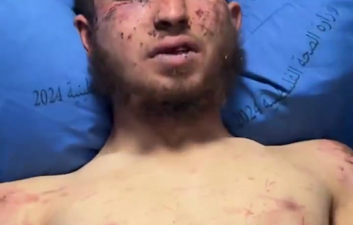Thumbnail preview image for the video titled: Israeli settlers abducted Palestinian youth Owais Hammam subjected him to severe beatings and torture