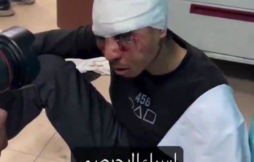 Thumbnail preview image for the video titled: Israeli soldiers brutally assaulted Ramadan Shamlakh, using chairs, knives, and household tools, threatening to cut off his fingers and ears