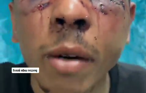 Thumbnail preview image for the video titled: Used as human shield Ramadan Shamlakh was then severly beaten: "They kicked me with their hard boots"