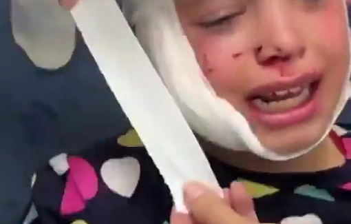 Thumbnail preview image for the video titled: Hiba and Mariam, 5 and 7, survived to the Israeli airstrike that killed her sister Dana Abu Ma’rouf in Khan Younis