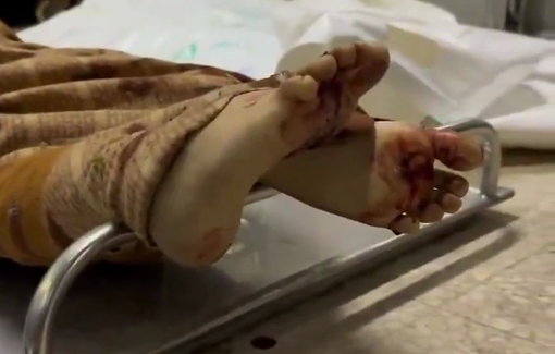 Thumbnail preview image for the video titled: Israel killed 12 Palestinians, including 7 children, in several attacks on Gaza tonight.