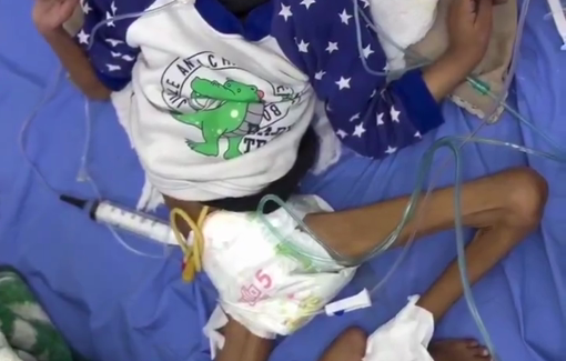 Thumbnail preview image for the video titled: The child Batoul Faraj, six years old, is suffering from severe malnutrition,