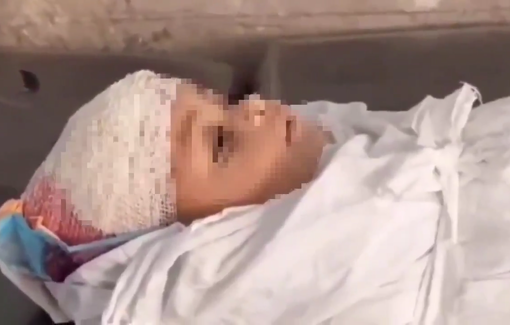 Thumbnail preview image for the video titled: Iyad Ahmad Naim Al-Rabay’a, 3, was killed when Israeli bombings struck tents housing displaced families in Al-Iqlimi,